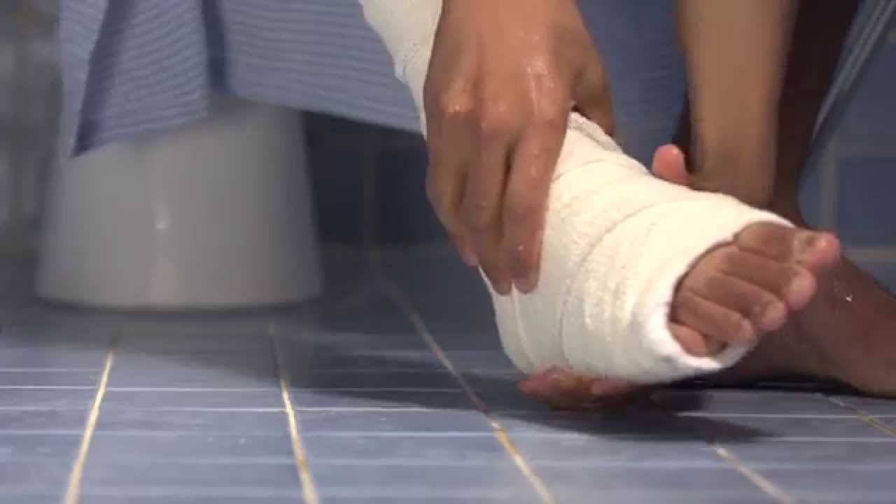 المسح على الخفين والجبيرة